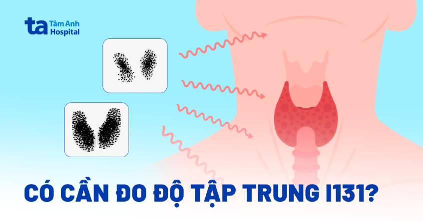 Có cần đo độ tập trung I131 không?