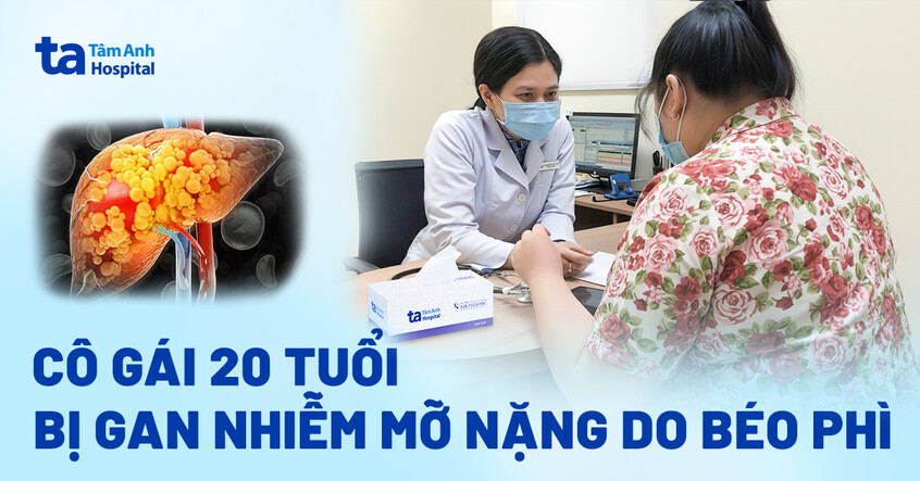 Cô gái 20 tuổi bị gan nhiễm mỡ nặng do béo phì