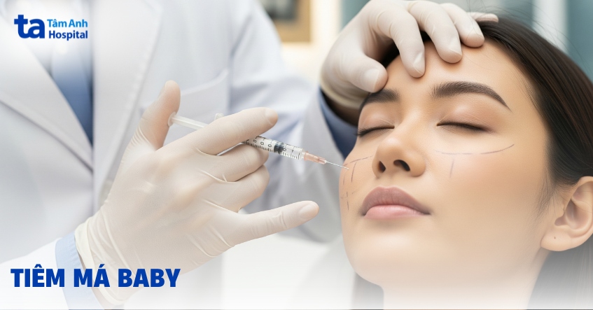 Tiêm má baby có hại không? Vì sao chị em ưa thích?