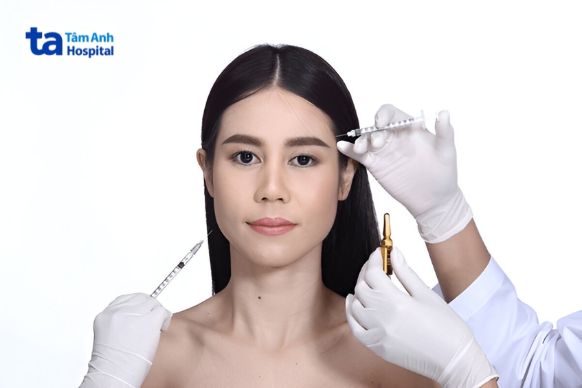 có thể kết hợp cả tiêm botox và tiêm filler không