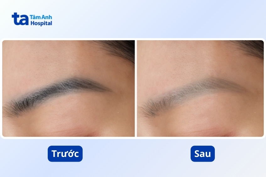 công nghệ điều trị hiệu quả