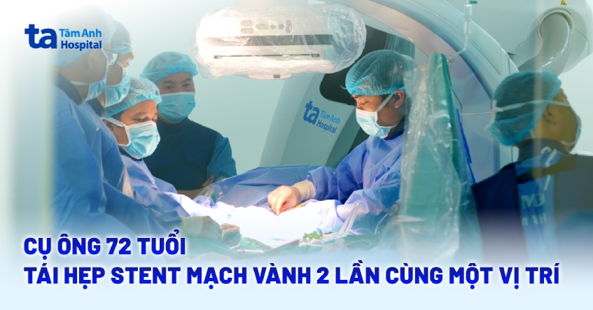 Cụ ông 72 tuổi tái hẹp stent mạch vành 2 lần cùng một vị trí