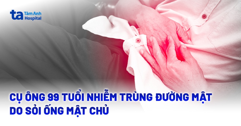 Cụ ông 99 tuổi nhiễm trùng đường mật do sỏi ống mật chủ