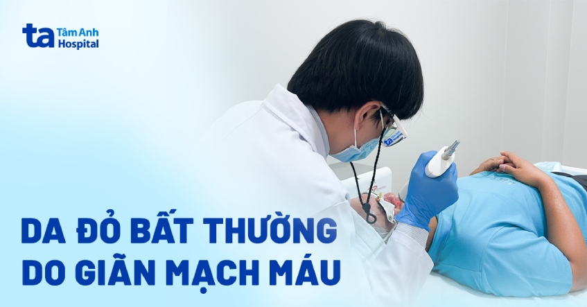 Da đỏ bất thường do giãn mạch máu