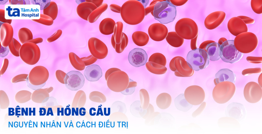 Bệnh đa hồng cầu là gì? Nguyên nhân, triệu chứng và cách điều trị