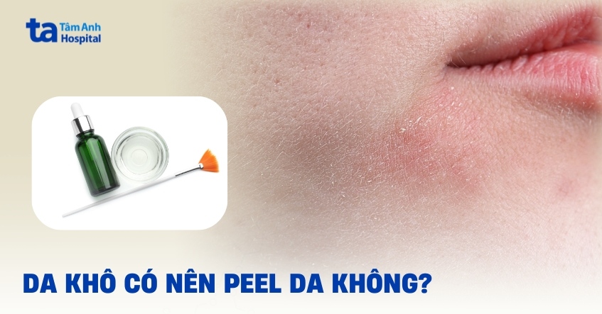 Giải đáp: Da khô có nên peel da không?