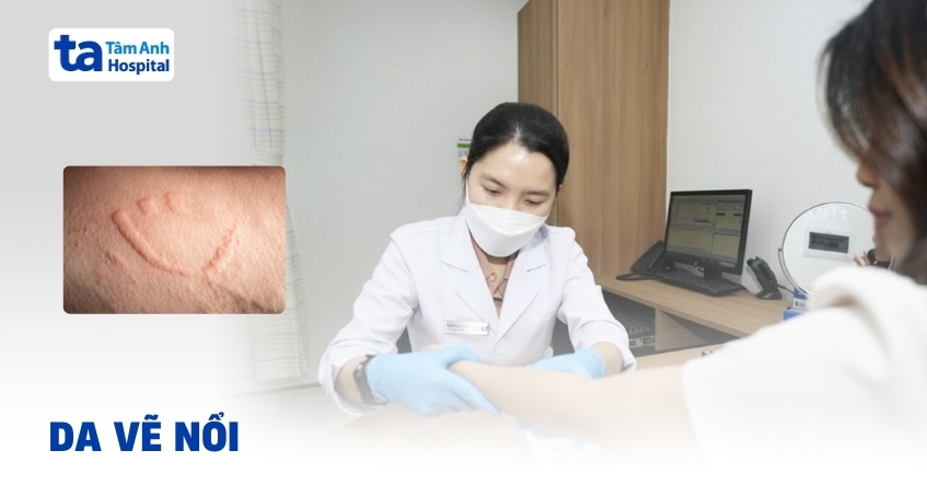 Da vẽ nổi có nguy hiểm không? Nhận biết và cách điều trị