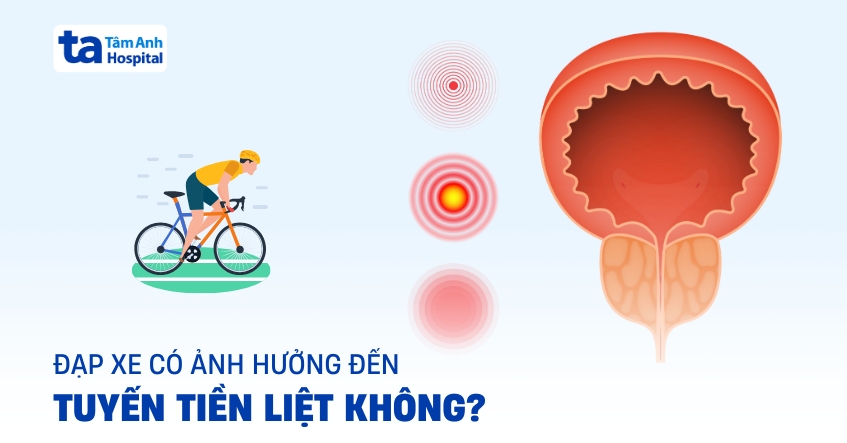Đạp xe có ảnh hưởng đến tuyến tiền liệt không? Mối liên hệ