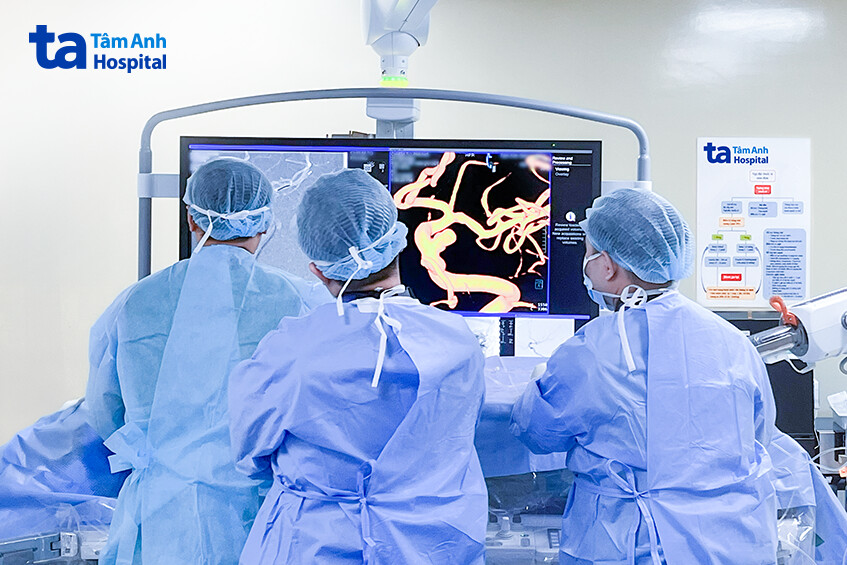 đặt stent thay đổi dòng chảy