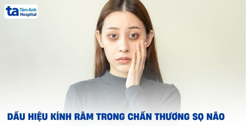 Tại sao xuất hiện dấu hiệu kính râm trong chấn thương sọ não?