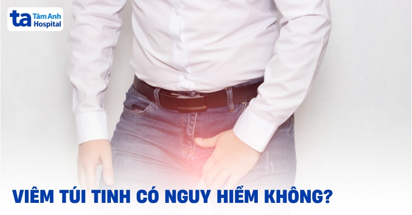 Viêm túi tinh: Nguyên nhân, dấu hiệu, biến chứng và điều trị