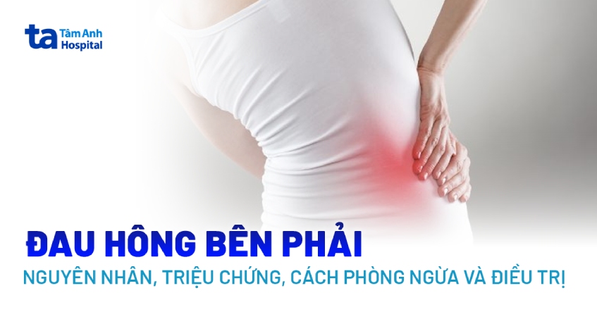 Đau hông bên phải: Cách điều trị và phòng ngừa từ sớm đúng cách