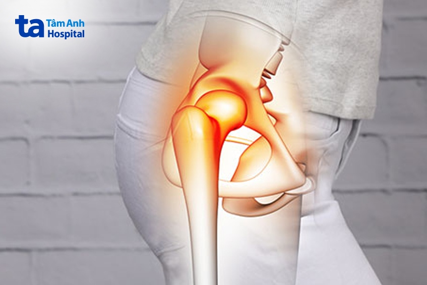 Đau nhức kèm cảm giác khó chịu vùng hông phải