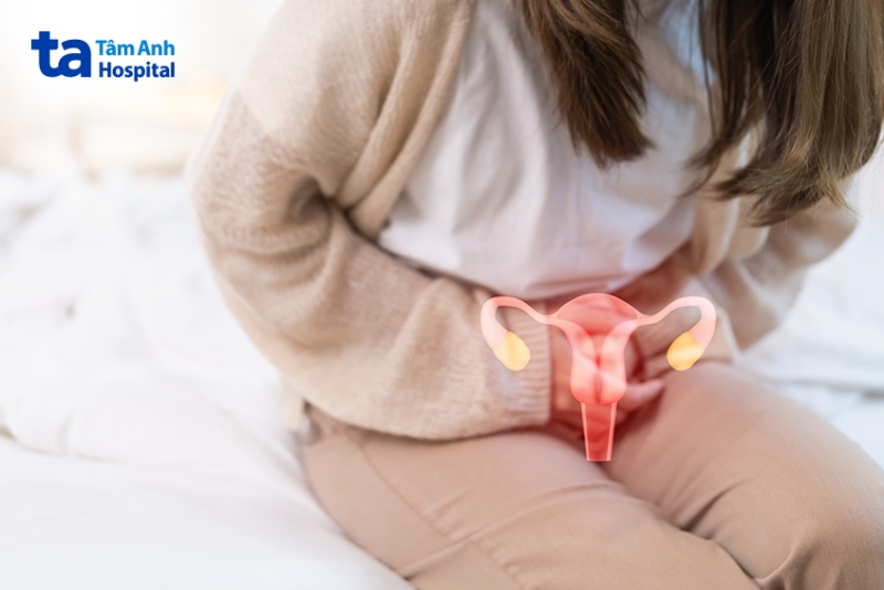 đau thắt bụng dưới trái