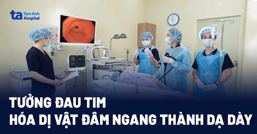 Tưởng bị bệnh tim hóa dị vật đâm ngang thành dạ dày