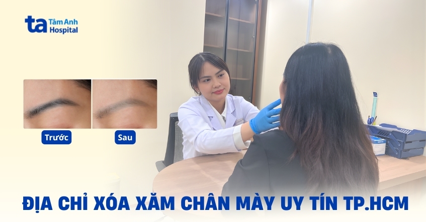 Địa chỉ xóa điêu khắc chân mày uy tín ở TPHCM sạch mực, ít đau