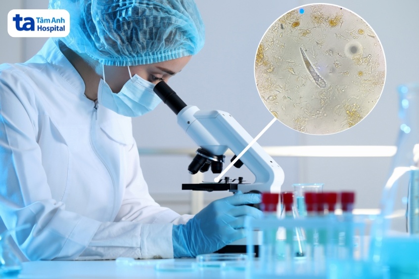 độ chính xác của xét nghiệm soi tươi demodex