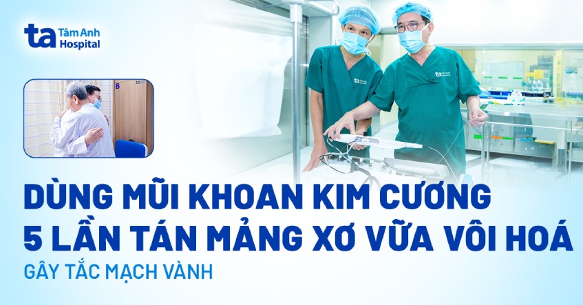 Dùng mũi khoan kim cương 5 lần tán mảng xơ vữa vôi hoá gây tắc mạch vành