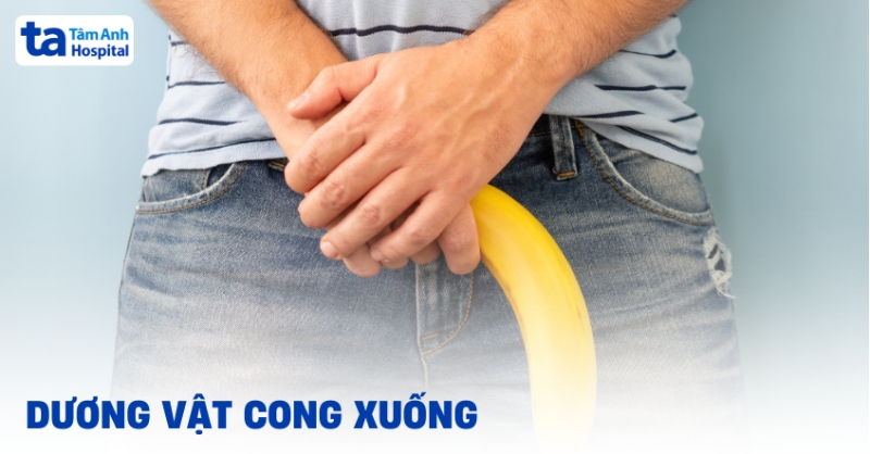 Dương vật cong xuống làm sao cho thẳng? Có ảnh hưởng gì không?