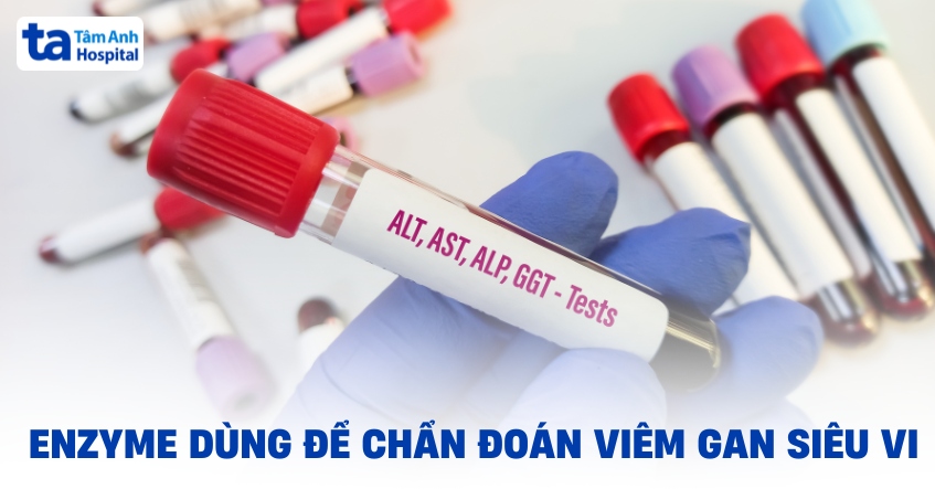 Enzyme dùng để chẩn đoán viêm gan siêu vi cấp