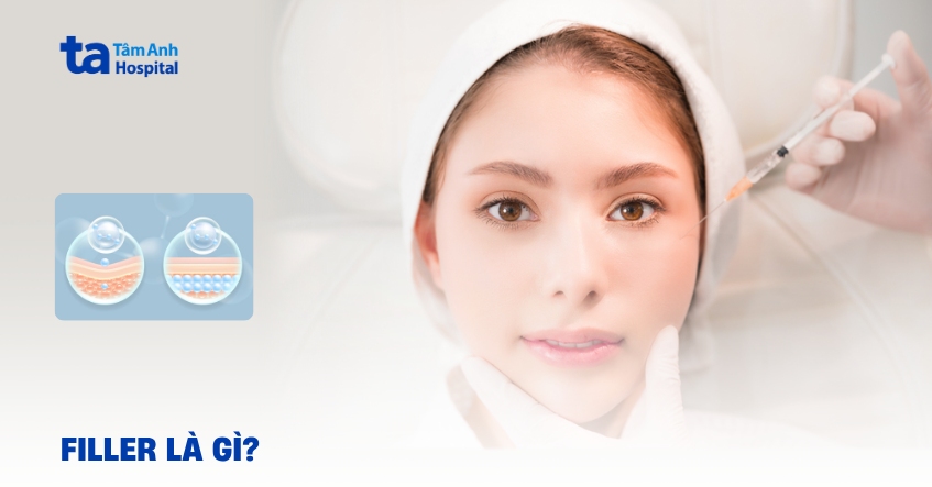 Filler là gì? Những lưu ý cần biết trước khi lựa chọn