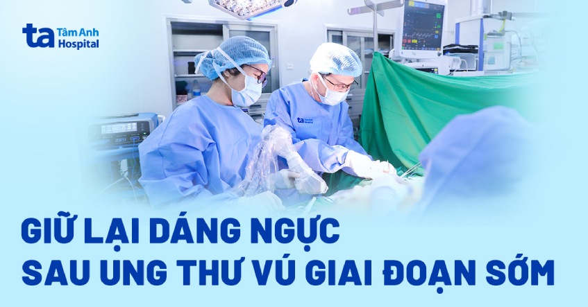 Giữ lại dáng ngực sau ung thư vú giai đoạn sớm
