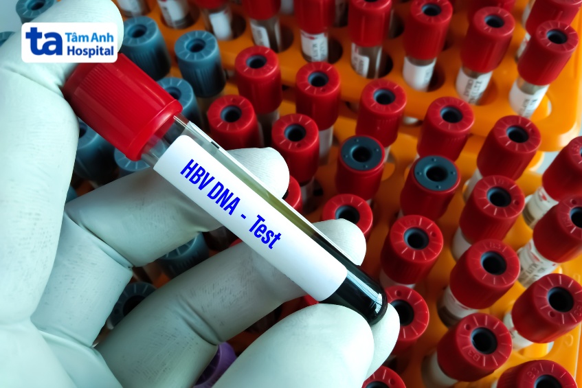 hbv dna định lượng