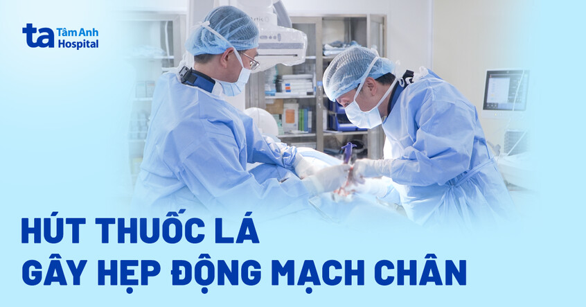 Hẹp mạch máu chân sau nhiều năm hút thuốc lá