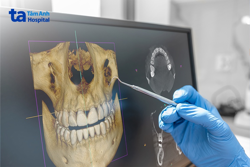 hình ảnh CT răng rõ nét