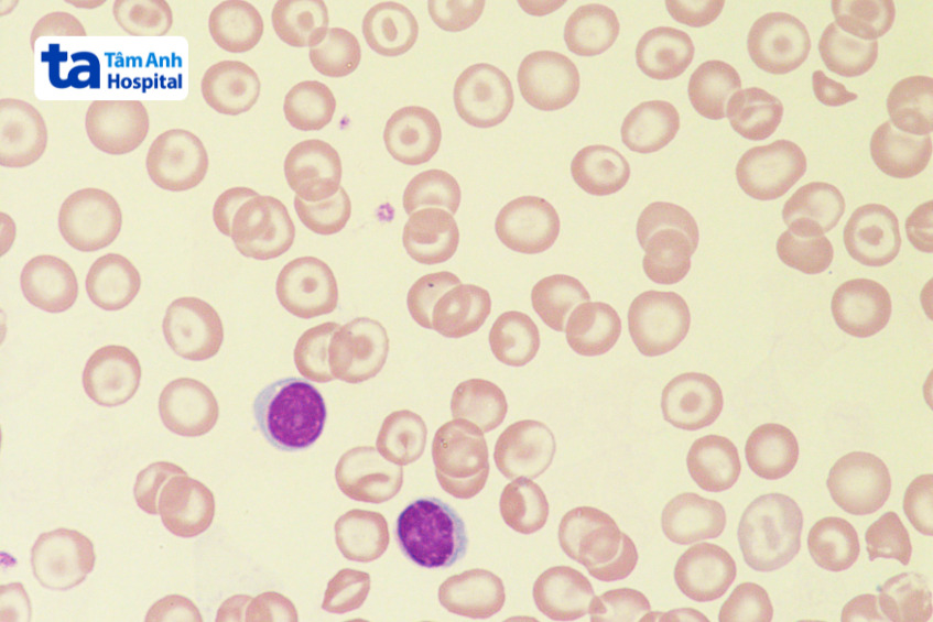 hình ảnh hồng cầu hình bia dưới kính hiển vi