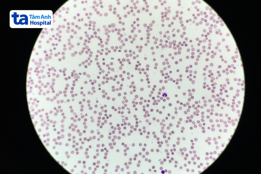 hình ảnh hồng cầu hình cầu