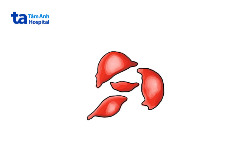 hình ảnh mảnh vỡ hồng cầu