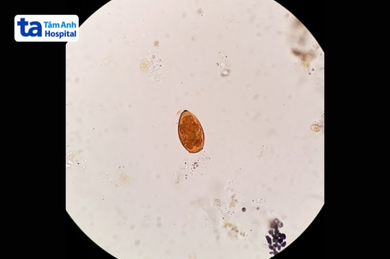 hình ảnh trứng sán dây cá