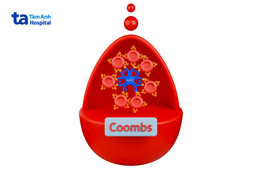 hình minh họa nghiệm pháp Coombs cho ra kết quả dương tính