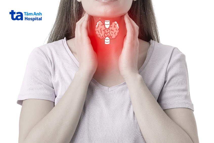 hình minh họa viêm tuyến giáp ở phụ nữ