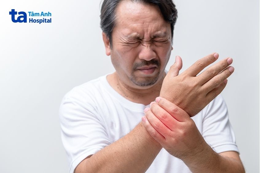hội chứng Felty là bệnh hiếm gặp