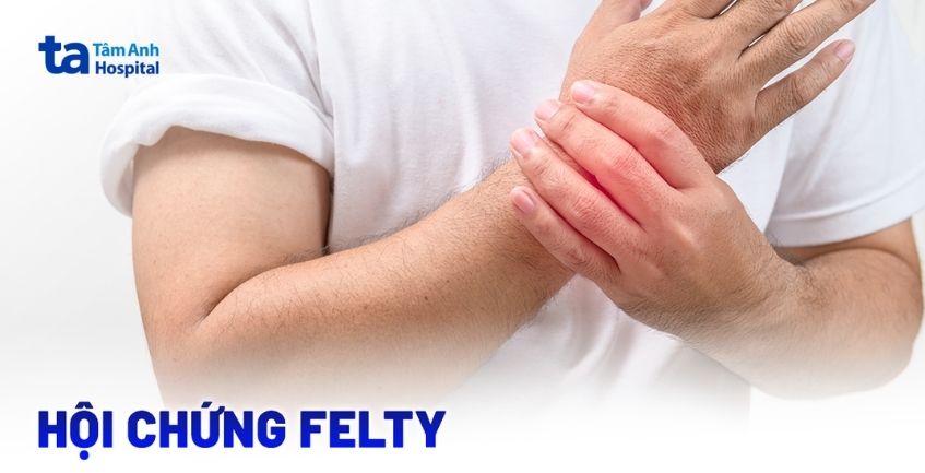 Hội chứng Felty: Bệnh hiếm gặp ít người biết