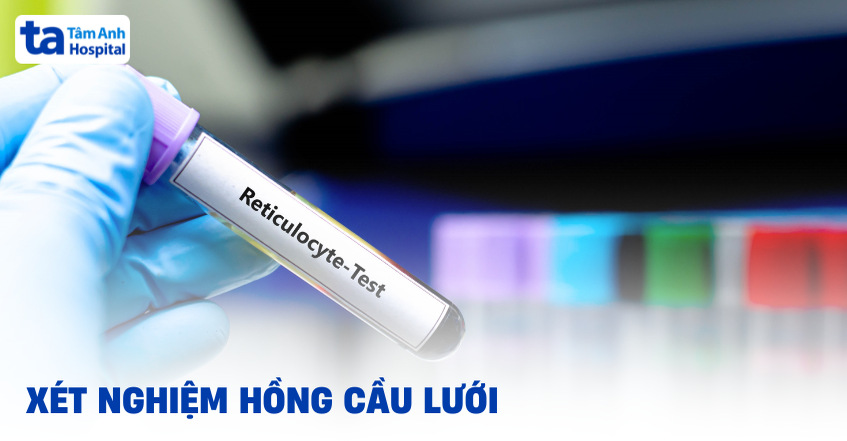 Hồng cầu lưới và các vấn đề khi xét nghiệm