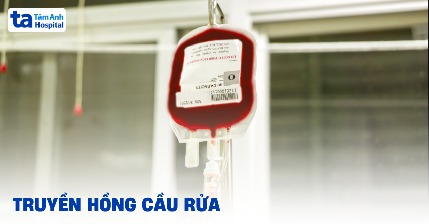 Chỉ định truyền hồng cầu rửa được thực hiện khi nào?