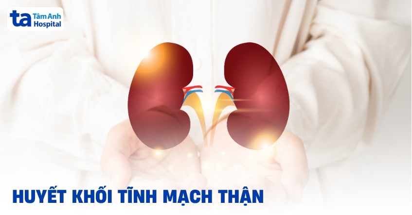 Huyết khối tĩnh mạch thận: Tất cả thông tin bạn cần biết