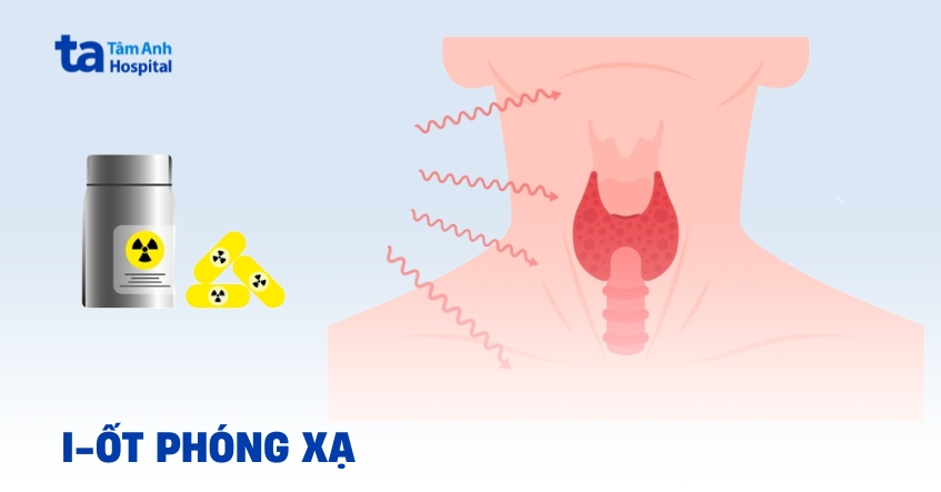 Ứng dụng i ốt phóng xạ trong điều trị các bệnh ung thư
