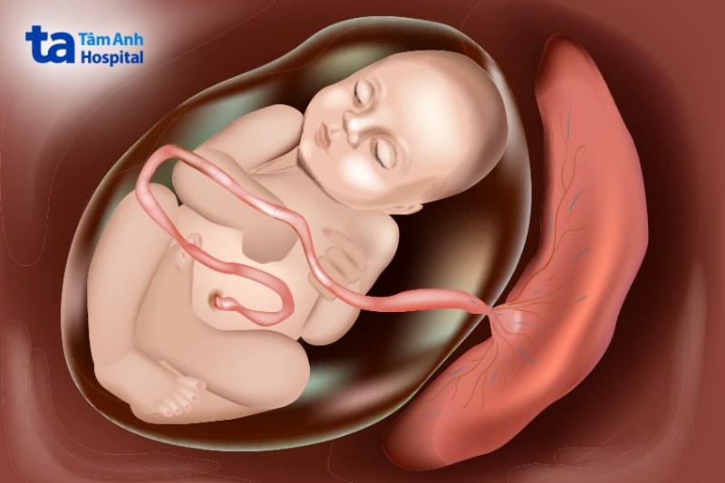 kết nối của dây rốn