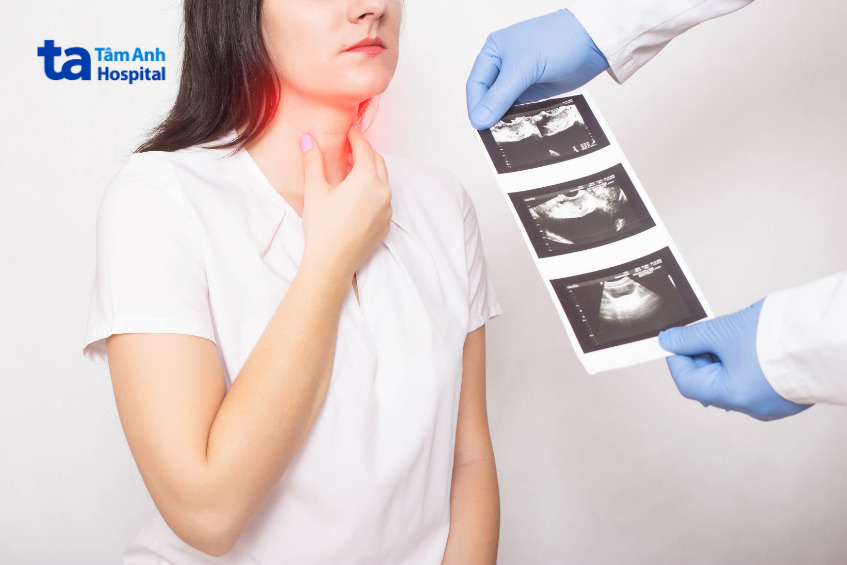 kết quả siêu âm cổ