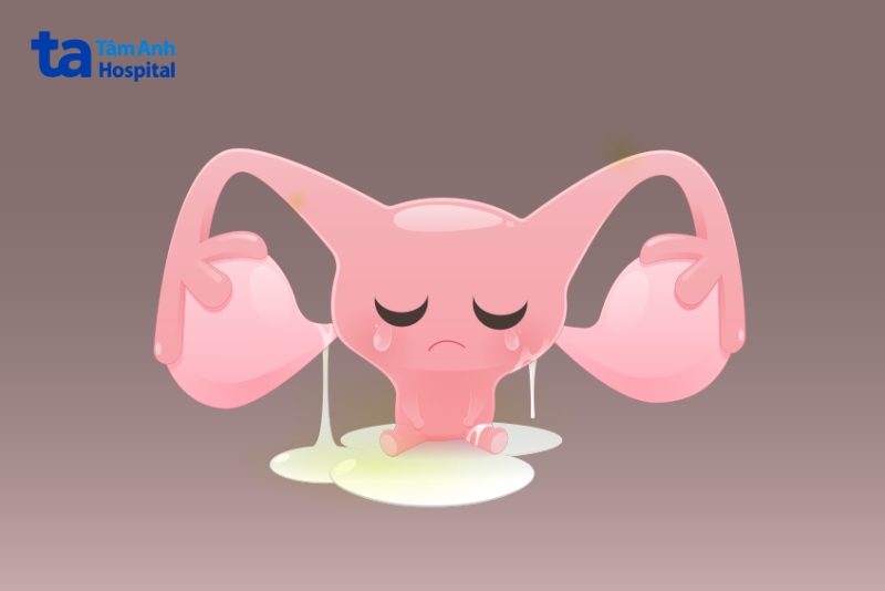 khí hư bã đậu do đâu