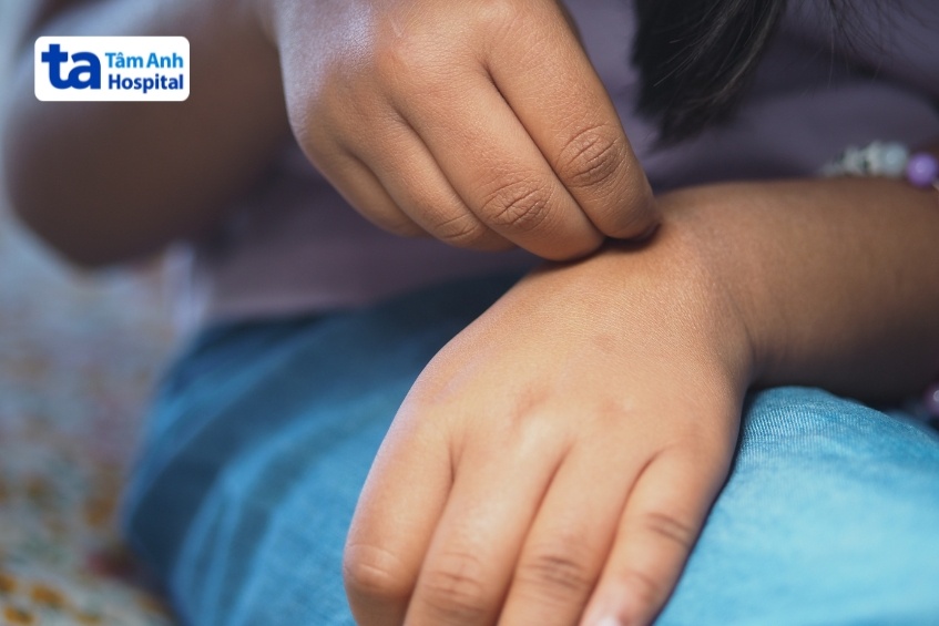 khi nào vòng tròn đỏ ở da là dấu hiệu bệnh lý