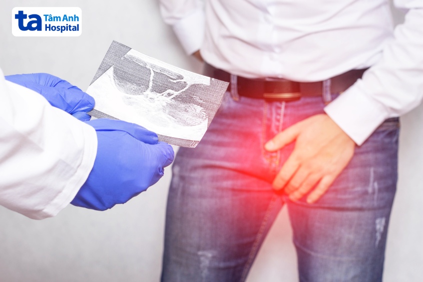 Khi xuất hiện đồng thời nhiều triệu chứng bất thường tinh hoàn, người bệnh cần chủ động thăm khám sớm