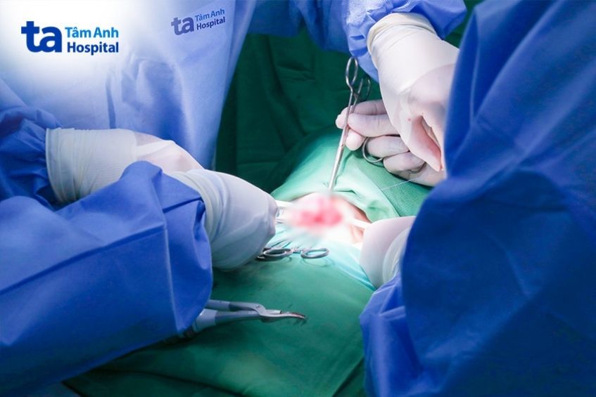 khối u ung thư tuyến giáp