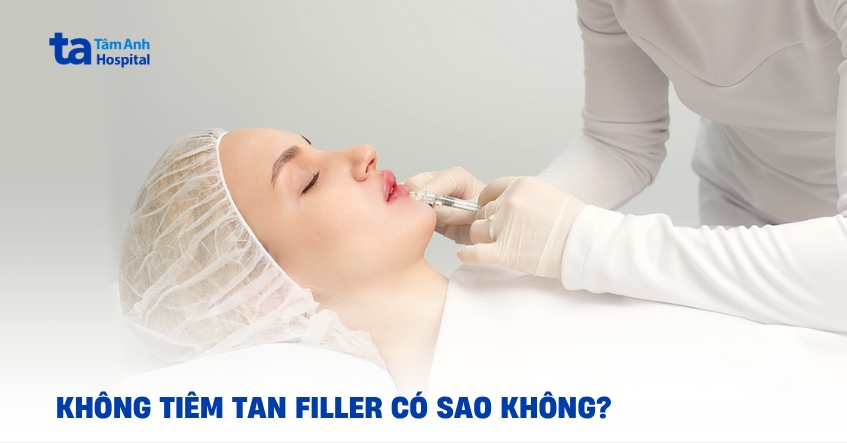 Không tiêm tan filler có thể gặp nguy cơ gì?