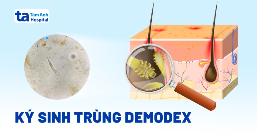 Ký sinh trùng Demodex: Cấu tạo hình thể và chu kỳ sinh trưởng