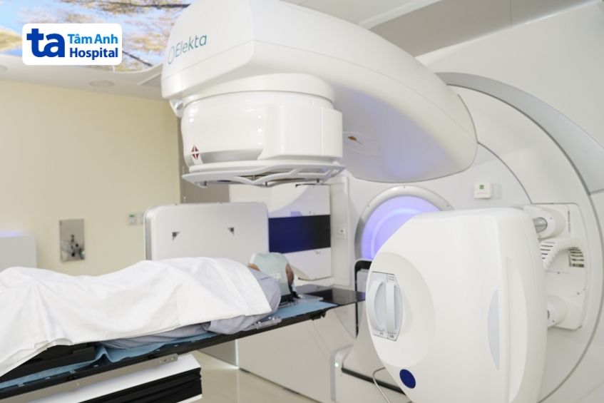 liệu trình xạ trị thường kéo dài từ 1-6 tuần, với số buổi điều trị có thể lên đến 30 buổi hoặc hơn, tùy vào giai đoạn và loại ung thư